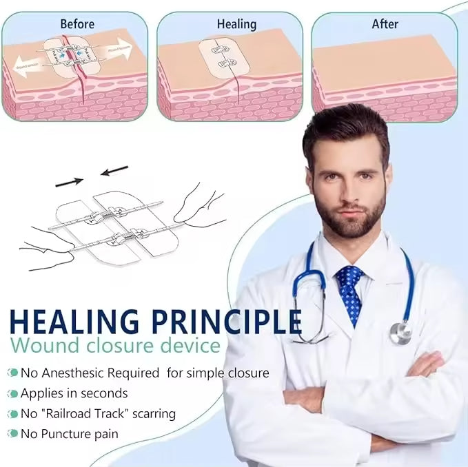 Non-Invasive Surgical Zip Stitches: Medical Grade Wound Closure Device