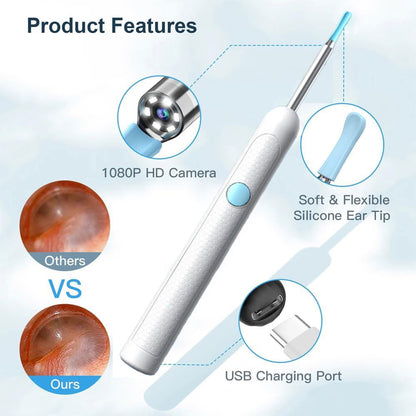 Ear Wax Removal Kit with Upgraded 1080p Camera, Ear Camera Otoscope with Light for iPhone, iPad, Android Phones