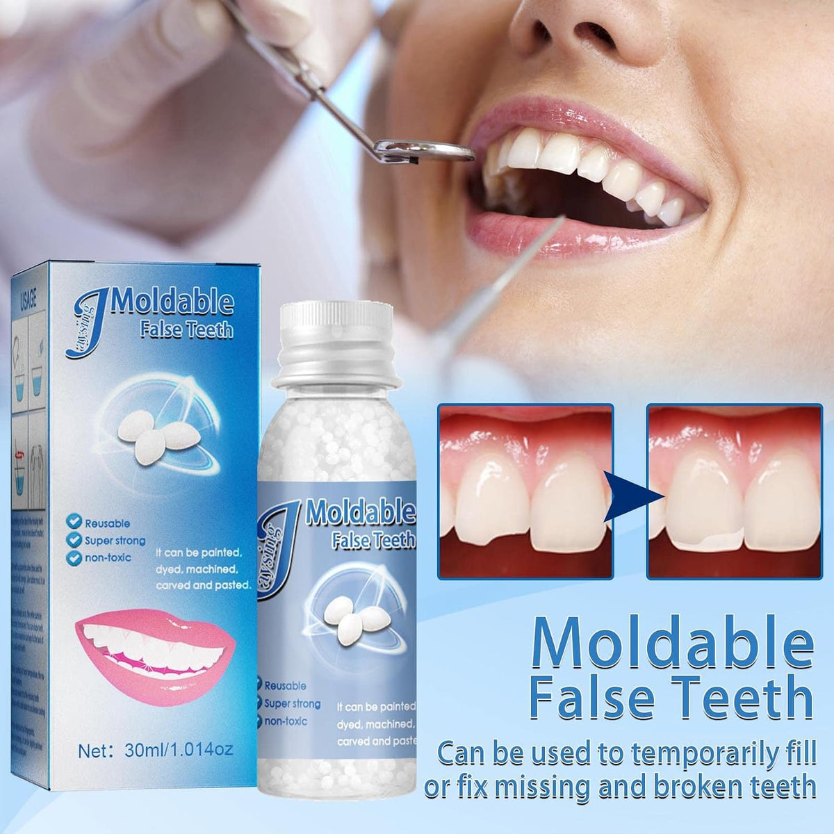 Moldable Temporary Tooth Repair Gel for Filling Gaps