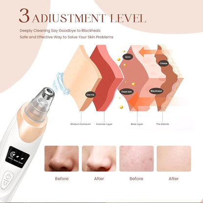 Rechargeable Blackhead Remover, Facial Pore Cleaner With 3 Adjustable Suction Powers, 5 Probes