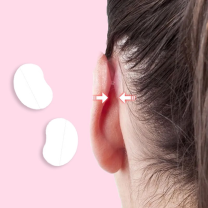 EarAlign™ - Comfortable ear shaping patches