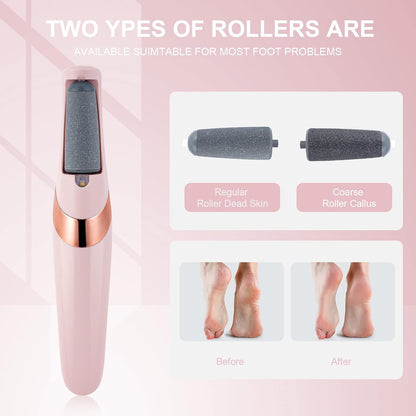 Electric Callus Removers for Feet