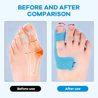 30PCS Pre‑Cut Bunion Corrector Kinesiology Tape