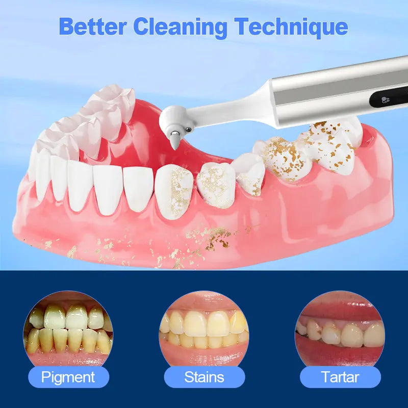 Electric Tooth Polisher with LED Light & 4 Modes