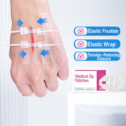 Non-Invasive Surgical Zip Stitches: Medical Grade Wound Closure Device