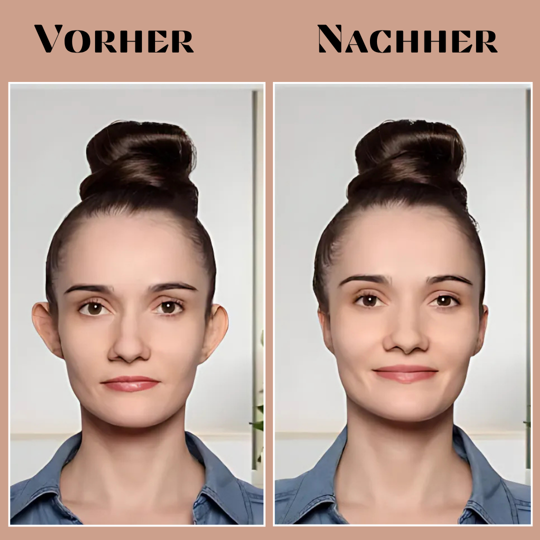 EarAlign™ - Comfortable ear shaping patches