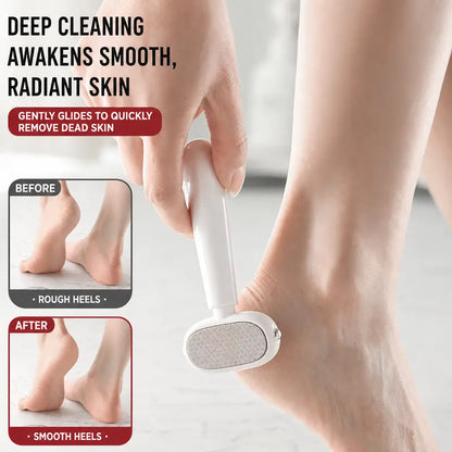 2PCS Dual‑Sided Foot Callus Remover