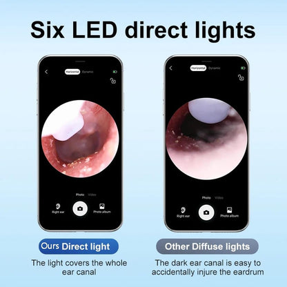 Ear Wax Removal Kit with Upgraded 1080p Camera, Ear Camera Otoscope with Light for iPhone, iPad, Android Phones