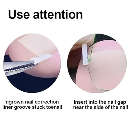 Professional Ingrown Toenail Toolkit with Breathable Ingrown Toenail Strips, Curved Toenails Corrector Patch