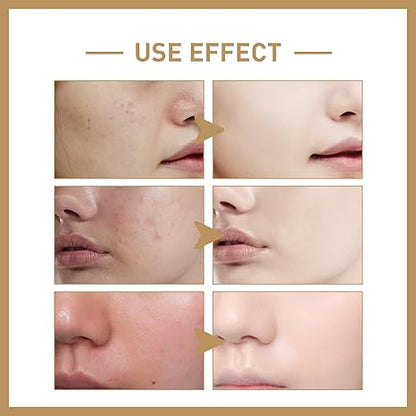 White Rice Toner, Hydrating Anti Aging Pore Minimizing Face Toners For Women