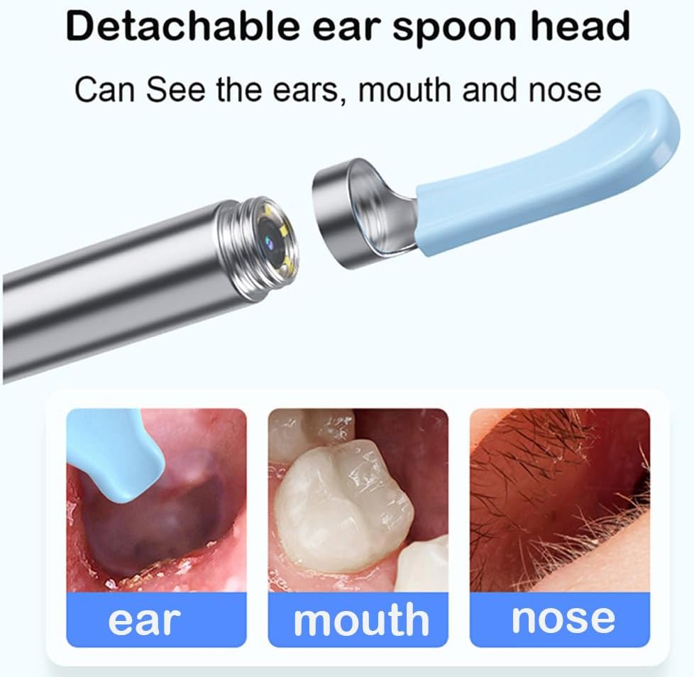Ear Wax Removal Kit with Upgraded 1080p Camera, Ear Camera Otoscope with Light for iPhone, iPad, Android Phones