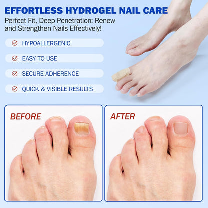 21Pcs Fungal Nail Patches: Extra Strength Treatment to Restore Healthy-Looking Nails