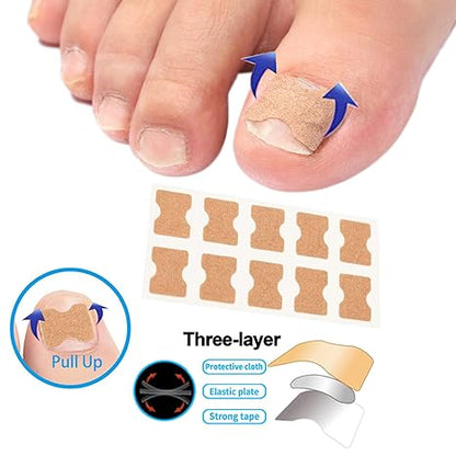Professional Ingrown Toenail Toolkit with Breathable Ingrown Toenail Strips, Curved Toenails Corrector Patch