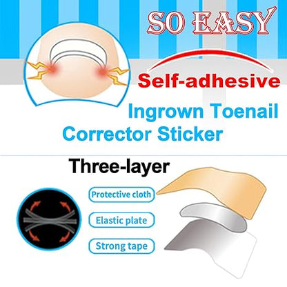 Professional Ingrown Toenail Toolkit with Breathable Ingrown Toenail Strips, Curved Toenails Corrector Patch
