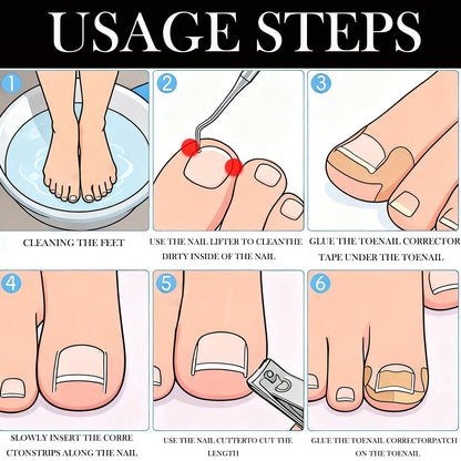 Professional Ingrown Toenail Toolkit with Breathable Ingrown Toenail Strips, Curved Toenails Corrector Patch