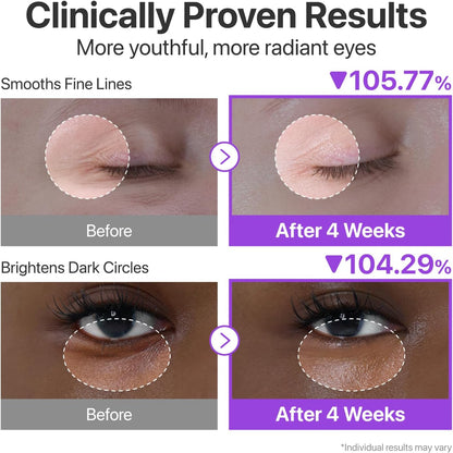 NAD+ Retinol Volumetox Eye Cream: Firming & Wrinkle Treatment
