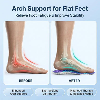 1 Pair Acupressure Insoles for Men and Women Magnetic Massage Insoles