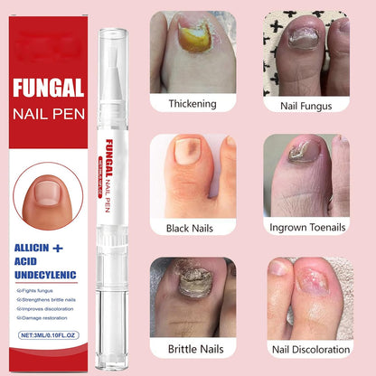 2pcs Fungal Nail Pens For Extra Strength Nail, Toenail & Fingernail Care