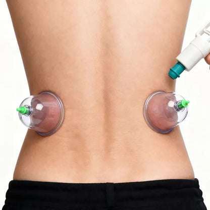 6-Piece Vacuum Cupping Massage Cup Set with Manual Hand Pump