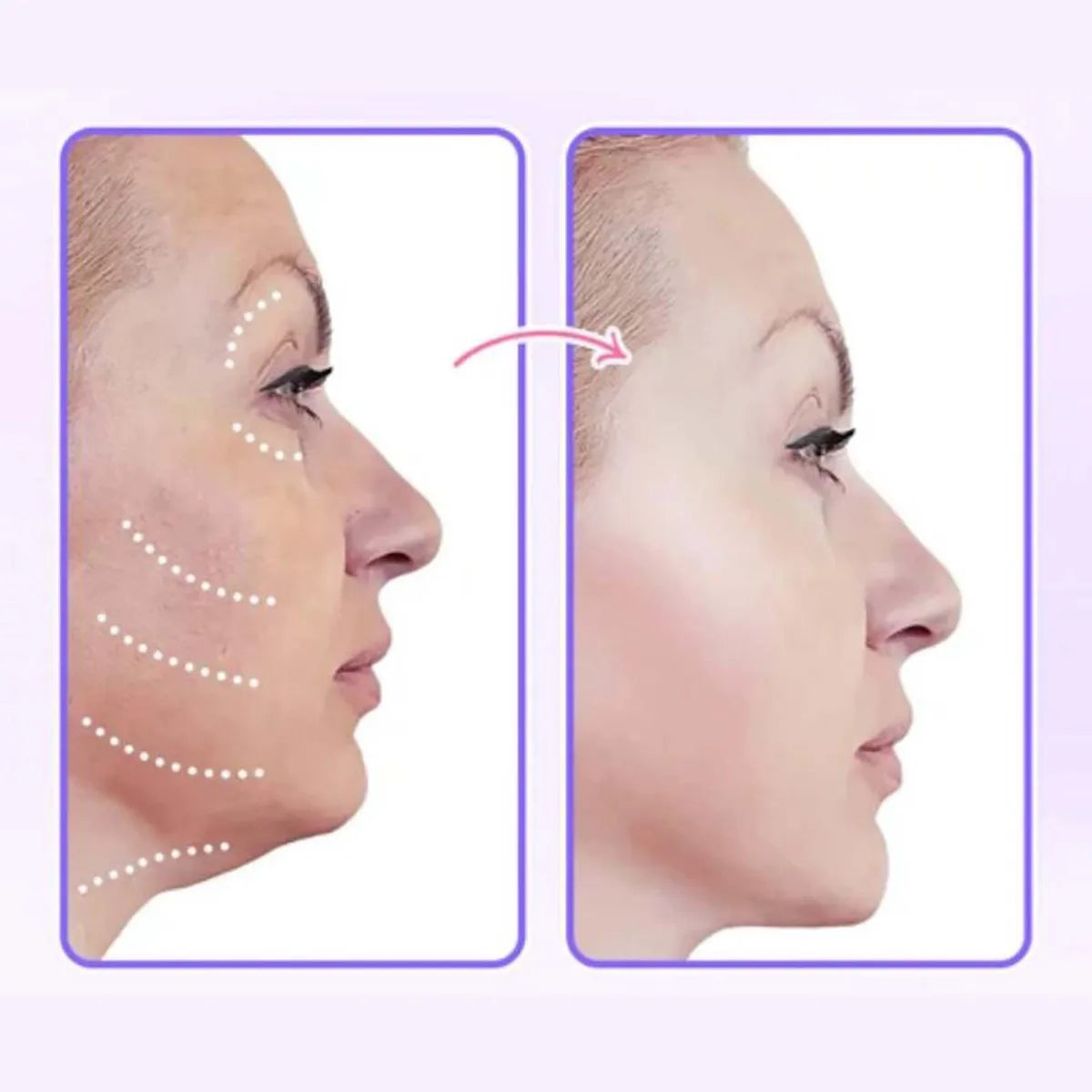 40Pcs/box Lift Face Sticker Face Chin Lift Tools