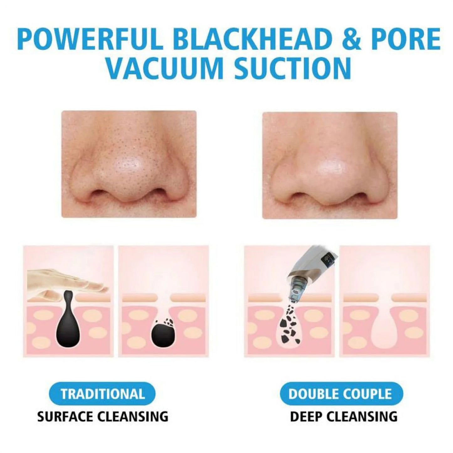 Rechargeable Blackhead Remover, Facial Pore Cleaner With 3 Adjustable Suction Powers, 5 Probes